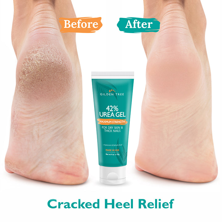 42% Urea Gel offers cracked heel relief overnight.