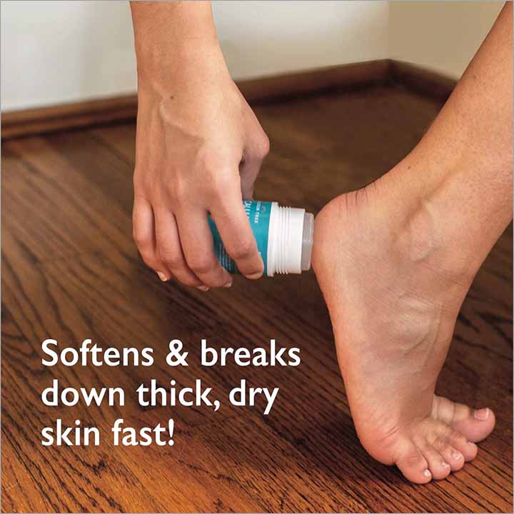 Gilden Tree Callus remover stick is easy to apply, and won't get your hands messy.