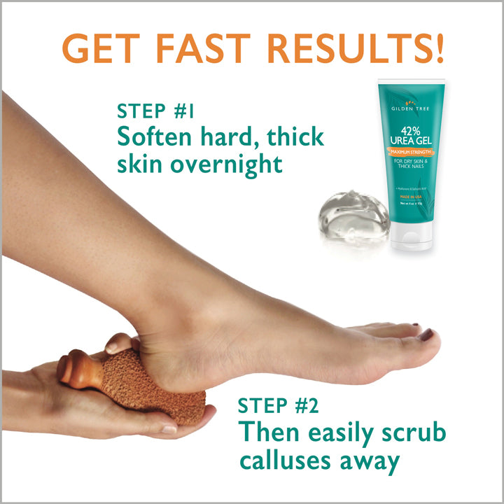 Get fast results with 42% Urea Gel softening thick skin and Foot Scrubber scrubbing calluses away.